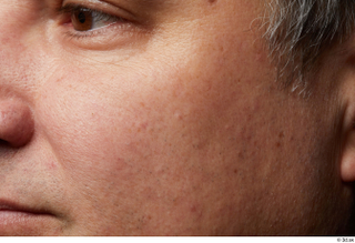  HD Face skin references Lukas Mina cheek skin pores skin texture wrinkles 0001.jpg
